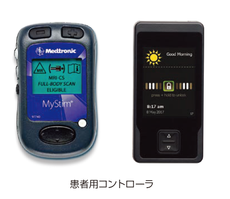 脊髄刺激療法と条件付きMRI対応デバイスについて | MRIfan.net