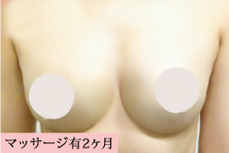 インフィニティ ブレスト クリーム Infinity Breast Cream - gran-9
