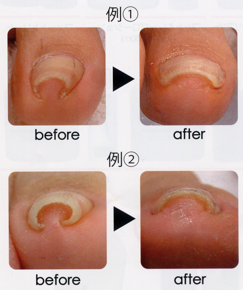 ドイツB/S SPANGE（スパンゲ）法 | たかはし施術院