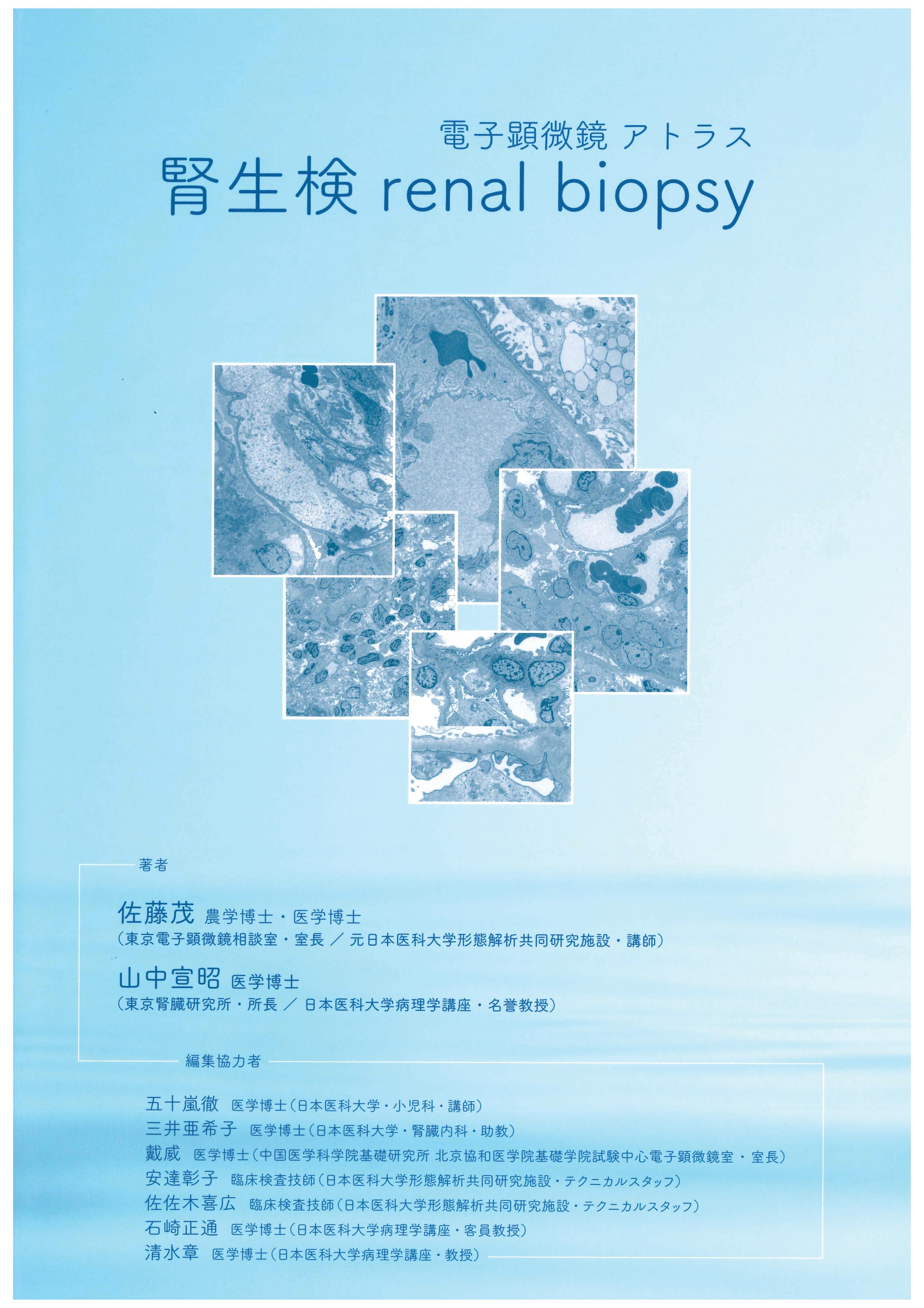 電子顕微鏡アトラス 腎生検 renal biopsy – Nisshin-EM