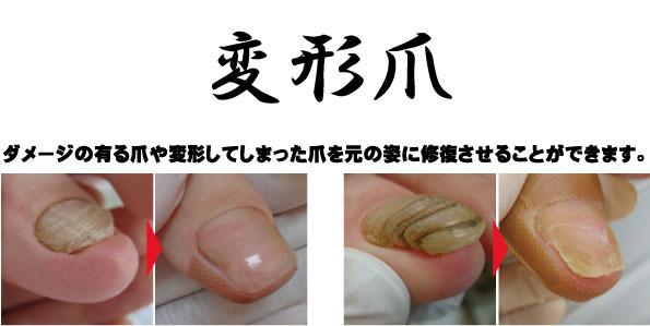 ペディグラステクノロジー ｜ 技術を学びたい方 コース紹介 ネイルリストア