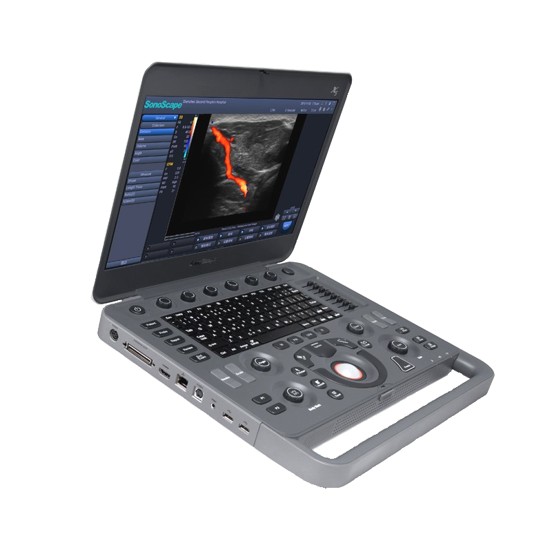 X5 ポータブルデジタル超音波診断装置｜湘栄ジャパン株式会社