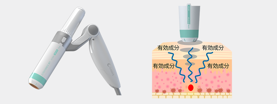 HIFU 超音波美容器 2ヘッド付き 医療HIFU ウルトラフォーマーMPT | ZX