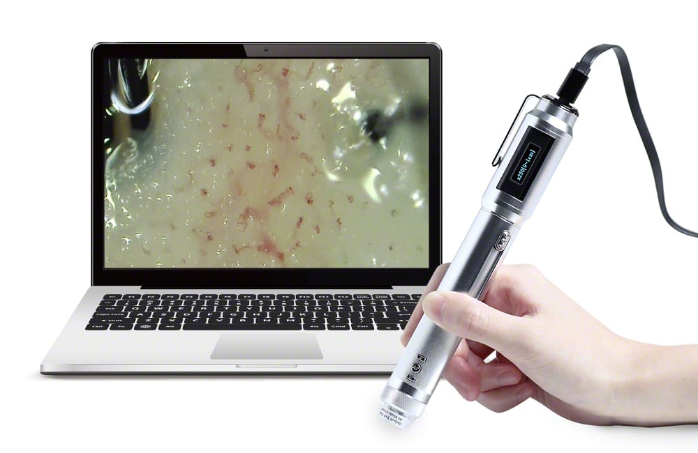 頭皮血流観察オートフォーカスマイクロスコープ VIEWTY 3R-MSBTVTY-H