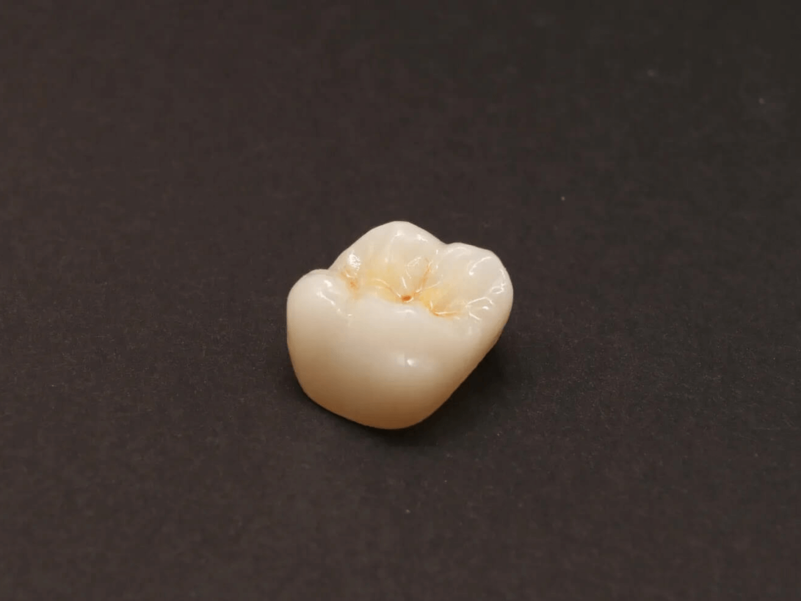 審美補綴物｜自然な見た目の美しい技工物