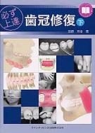 楽天市場】必ず上達歯冠修復の通販
