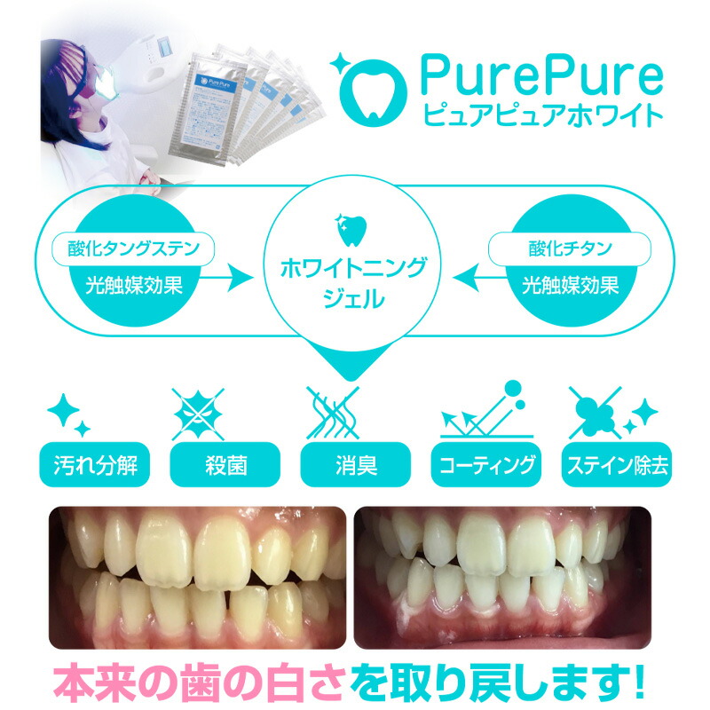 楽天市場】業務用 簡易セット 世界初！ 酸化タングステン 配合 ジェル