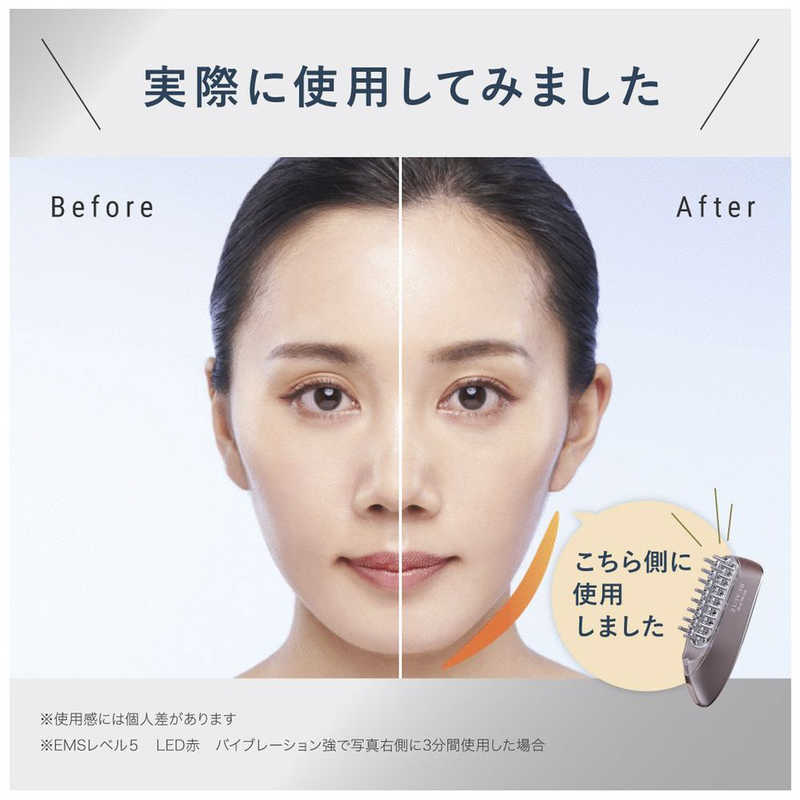 楽天市場】ANGFA スカルプD ボーテ スカルプ電気ブラシ KKS189