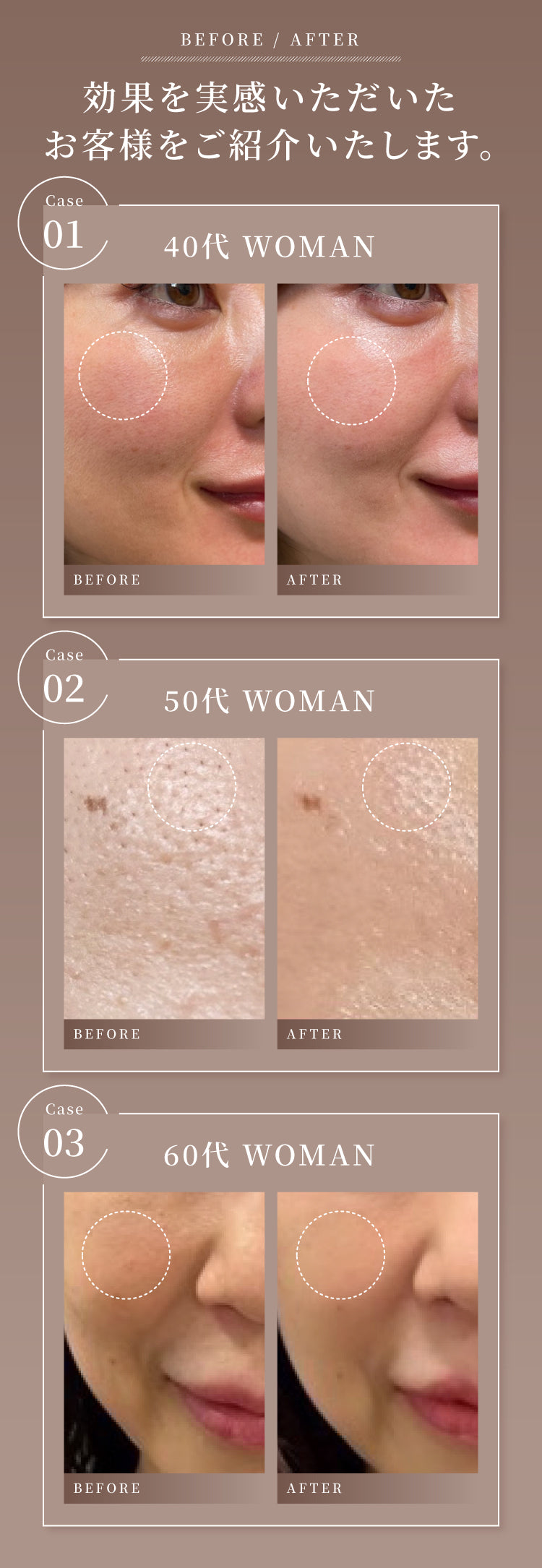 公式】UMBILICAL（アンビリカル）プレミアム エイジングケア