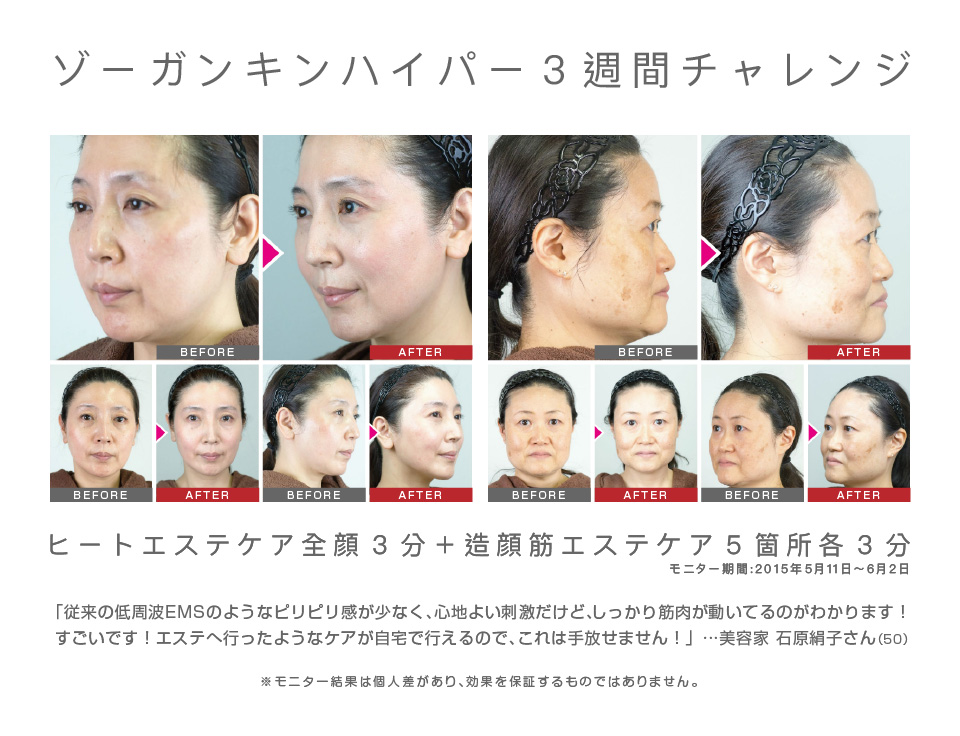 ZOGANKIN HYPER (ゾーガンキンハイパー) PINK GOLD | 公式サイト