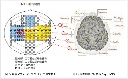 脳波（EEG）との同時計測 : 分析計測機器（分析装置） 島津製作所