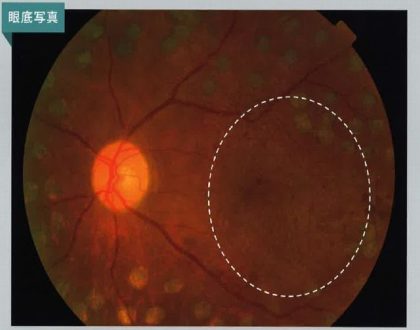 足立区で網膜硝子体手術ならアリオ眼科メディカルクリニック