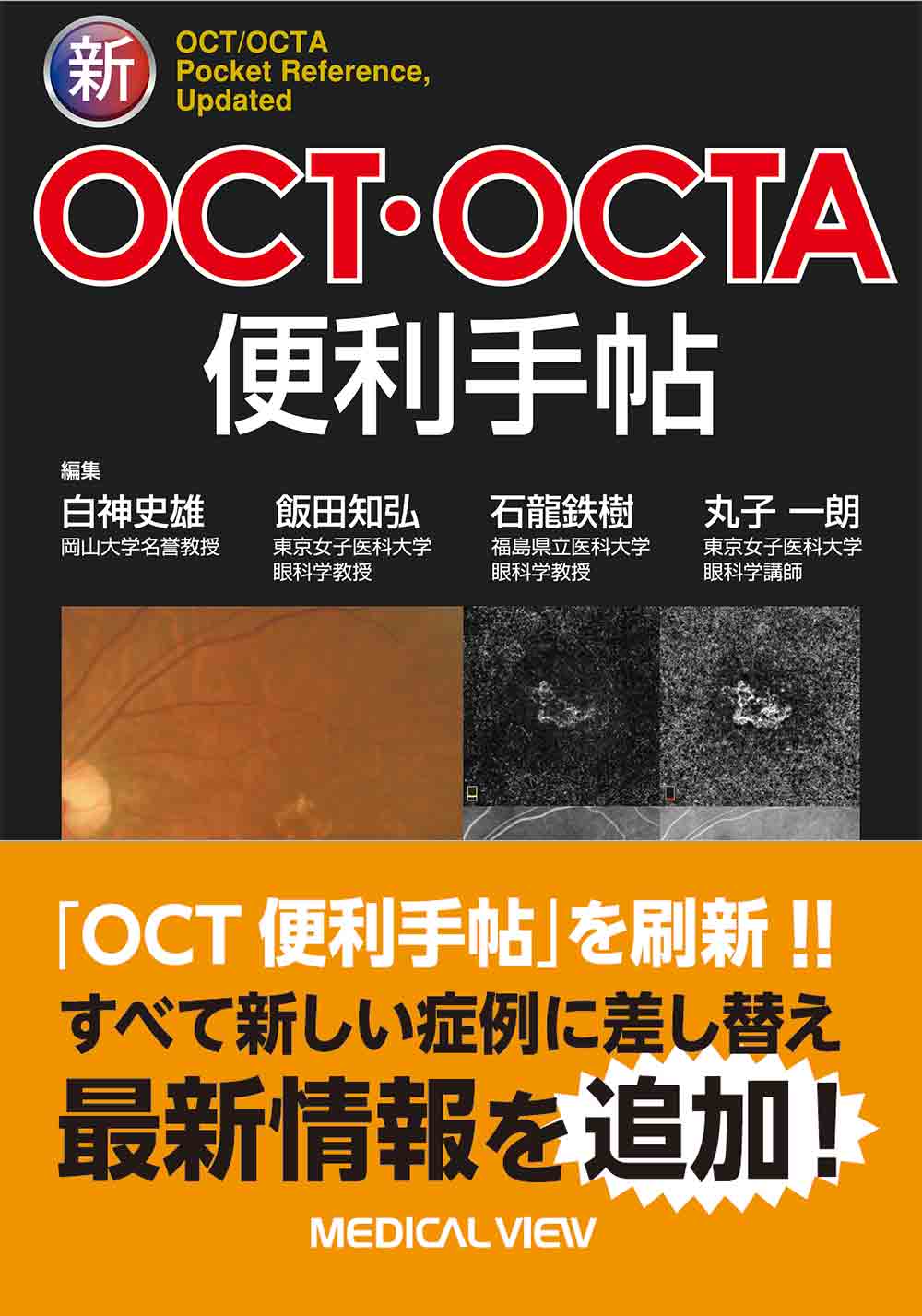 新OCT/OCTA便利手帖 - 眼科専門書店 オー・ビー・エス online shop