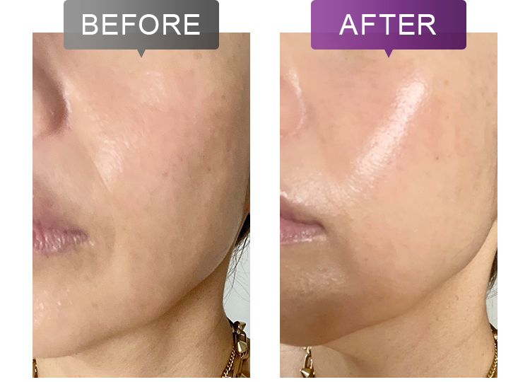 リジュビー3 | スキンケア化粧品・サイエンスコスメのビーグレン（b.glen）