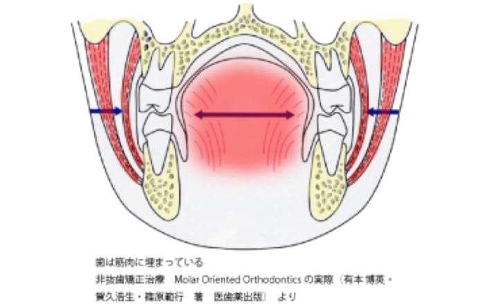 MOOフィロソフィーによる非抜歯矯正治療 - イースマイル国際矯正歯科