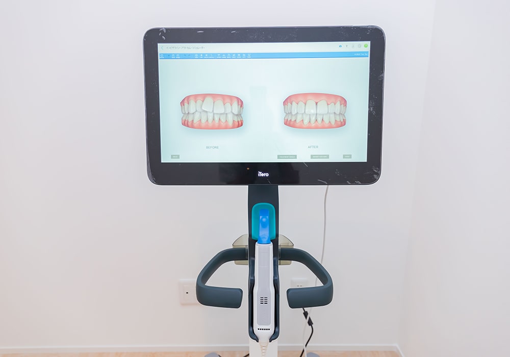 マウスピース矯正｜歯科｜かねむらNAOKOデンタルクリニック