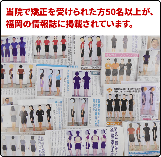 O脚・美脚矯正へのこだわり｜福岡市博多の整体・専門矯正の博多カイロ