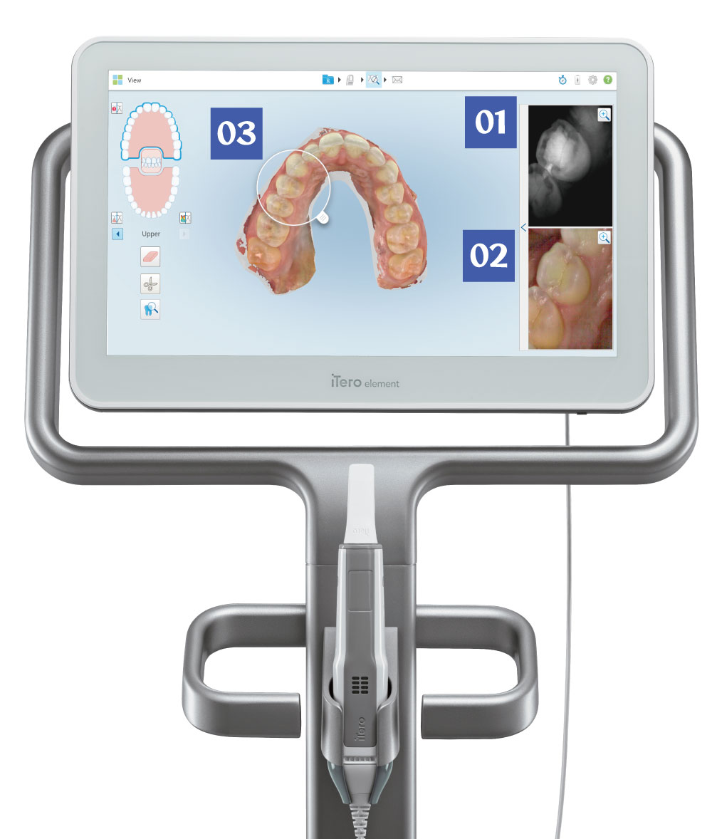 iTero element（口腔内スキャナー） | 歯科材料、歯科技工材料の通販