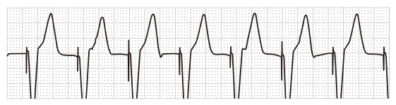 へるす出版 『第47回救急救命士国家試験問題 解答・解説集』訂正のおしらせ
