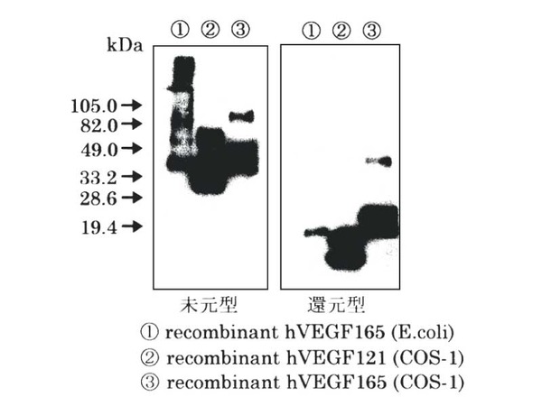 18411 Anti-Human VEGF (V-N) Rabbit IgG Affinity Purify | 株式会社