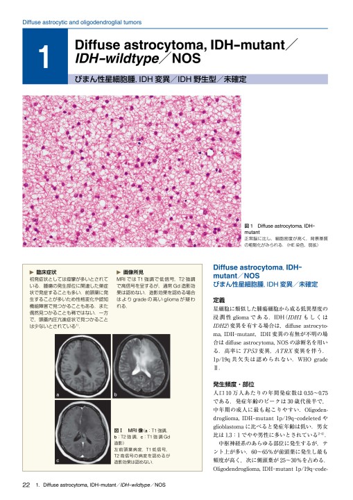 脳腫瘍臨床病理カラーアトラス 第4版』 立ち読み