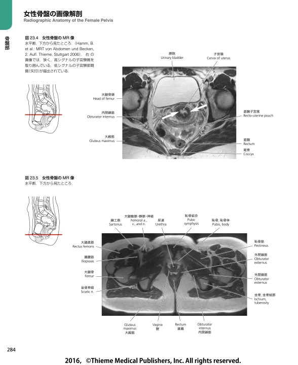 プロメテウス解剖学コアアトラス 第3版』 立ち読み