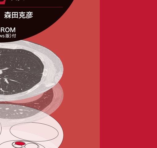 末梢病変を捉える 気管支鏡“枝読み”術 [DVD-ROM（Windows版）付] 第2版