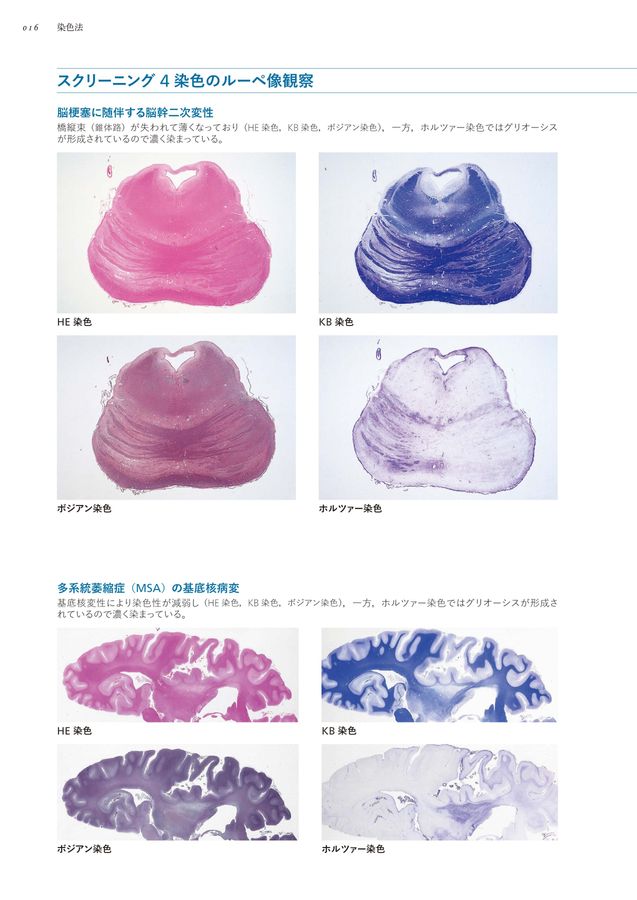 神経病理インデックス_第2版_立読み