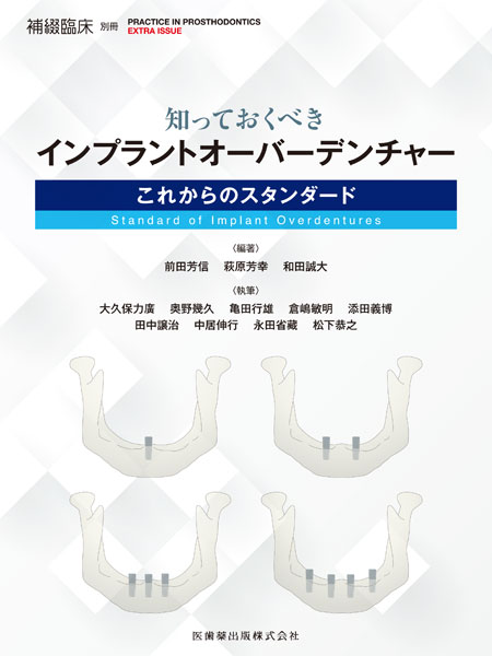 隔月刊「補綴臨床」別冊 知っておくべきインプラントオーバー