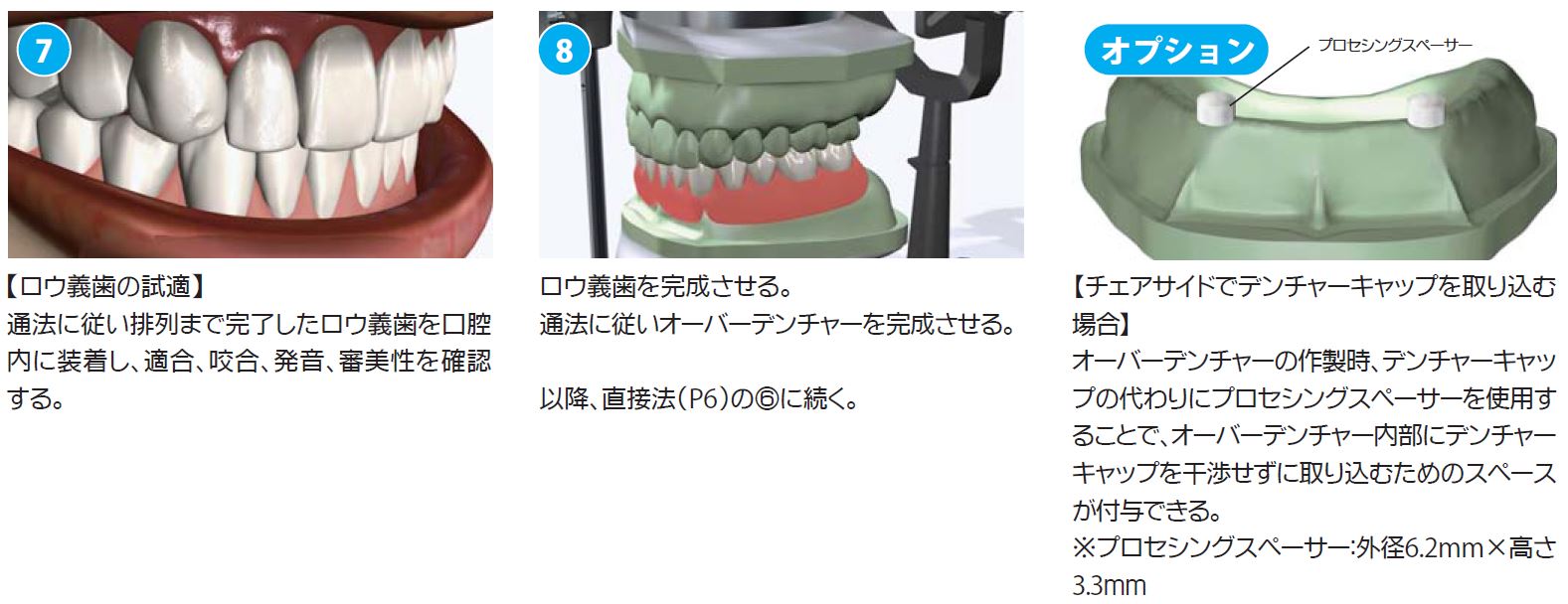 アバットメント(ロケーター）|株式会社インプラテックス