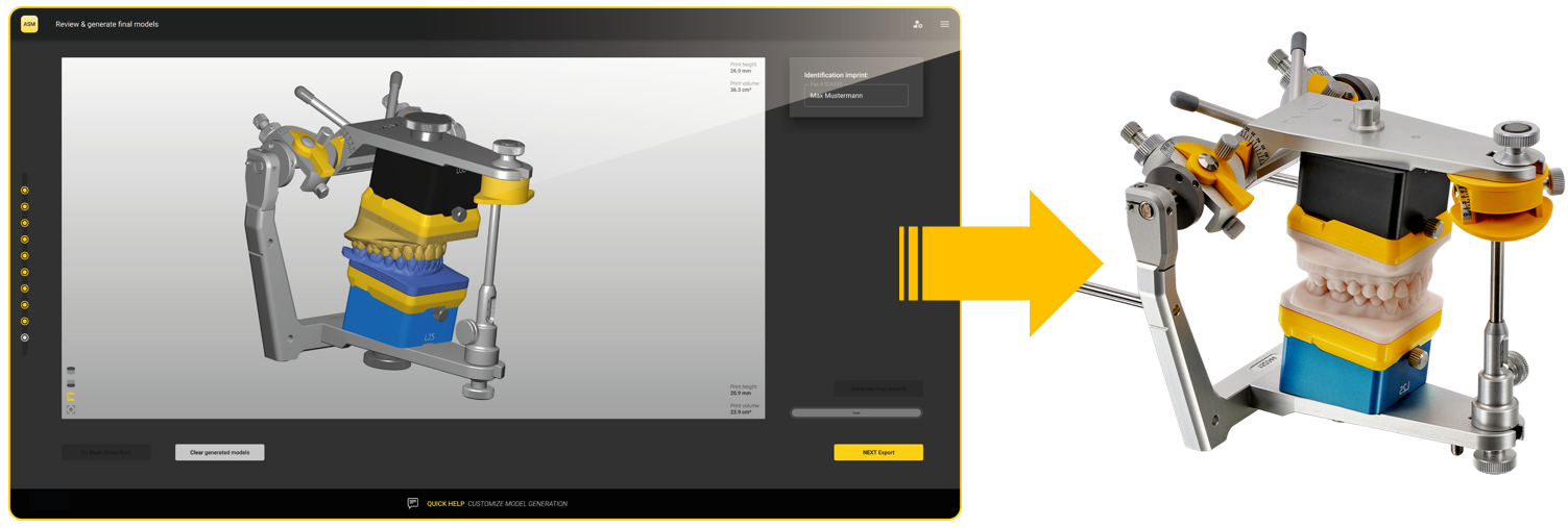 AxioSnapMount（アキシオスナップマウント） | 株式会社 JM Ortho