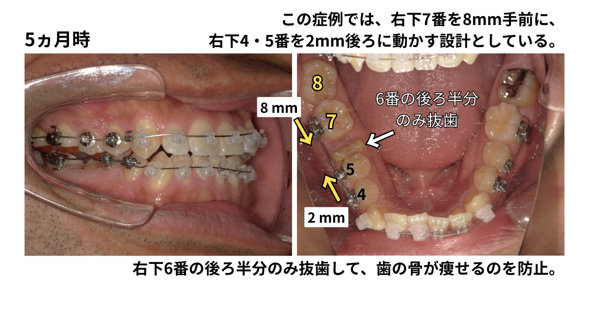 ブログ | 横浜市港北区【JOY矯正歯科クリニック】