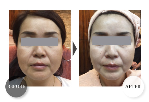 RESTORATION PACK｜MONNALI - 株式会社モナリ