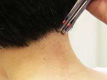 イトオテルミー温熱療法（大阪）