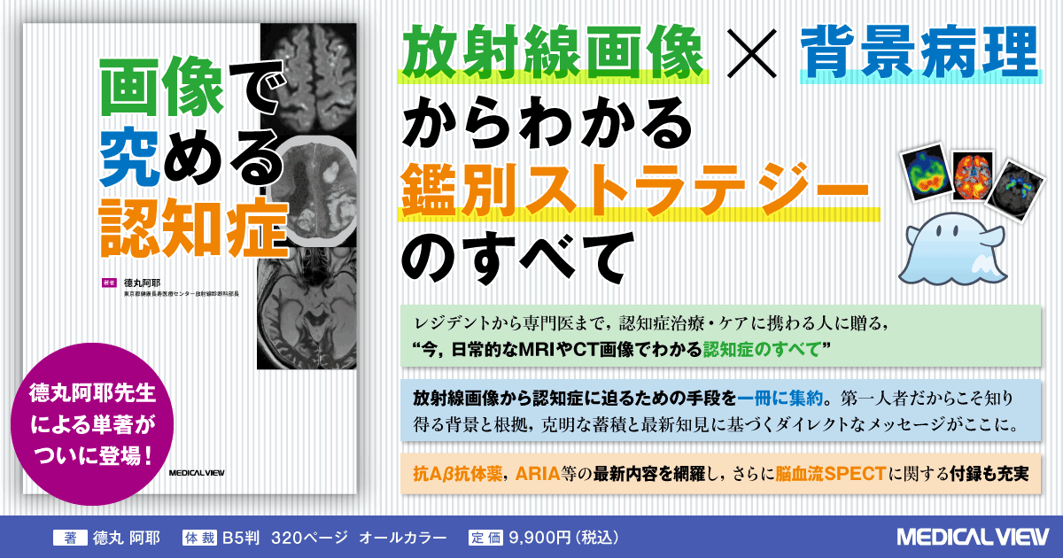 メジカルビュー社｜画像医学・放射線医学｜画像で究める認知症