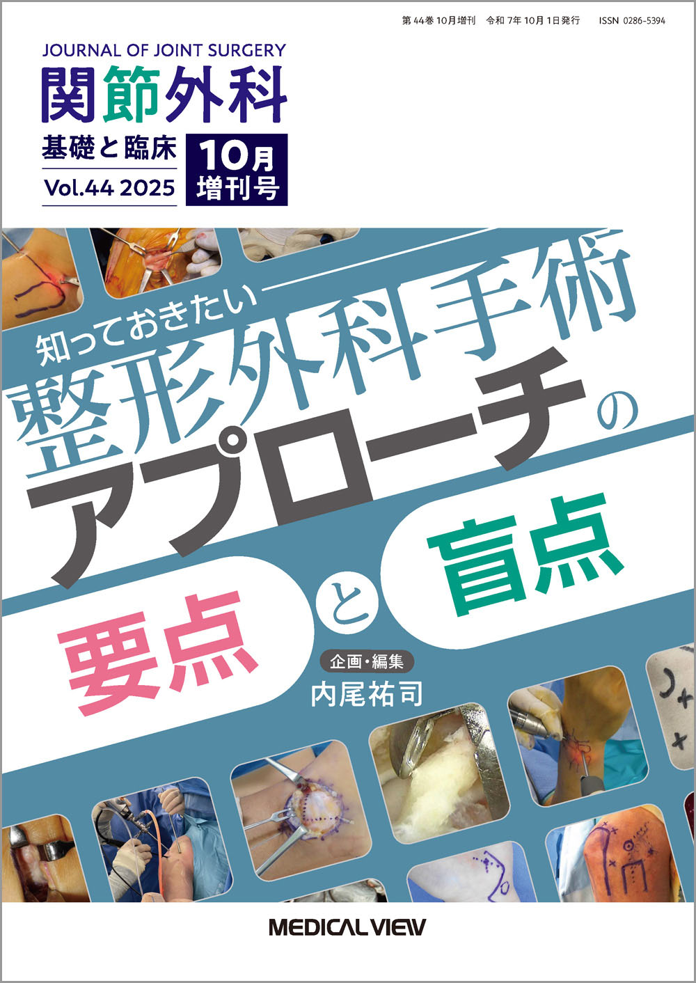 メジカルビュー社｜関節外科特集一覧｜関節外科 2025年10月増刊号