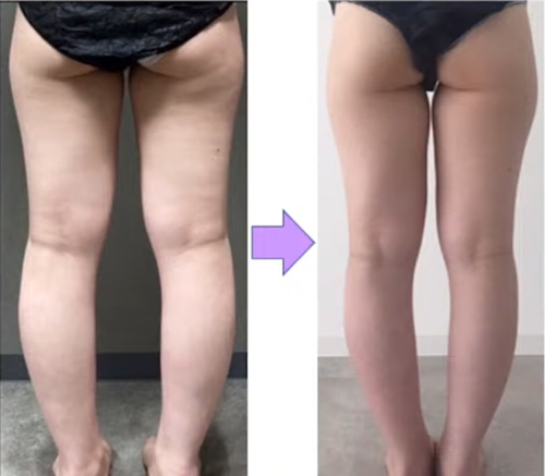 ノンFドラゴン | ノンエフドラゴン詰め替え用 500g