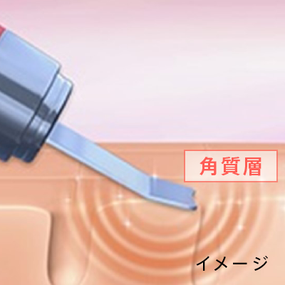 ダブルピーリング プロ クイーン｜カンタン、キレイ、お風呂でエステ