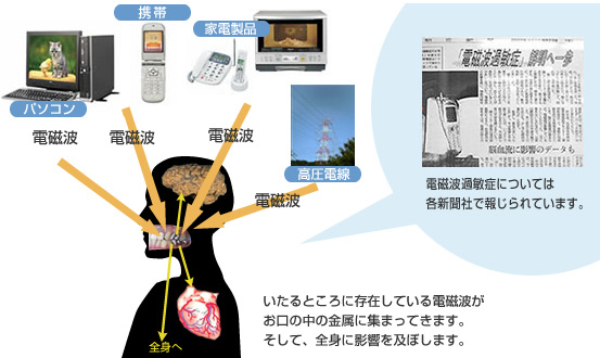 豊中市の歯医者 日本歯周病学会認定専門医 中垣歯科医院－噛み合わせ