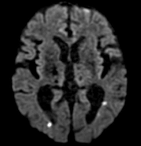 MRI検査について｜大阪市天王寺区のあづま脳神経外科