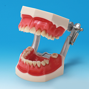歯周病説明用顎模型 [PE-PER003(P15D-TRM.653)]｜株式会社ニッシン