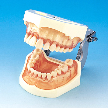 SRP実習用顎模型 [P15FE-DOT.2]｜株式会社ニッシン｜歯科模型・歯科