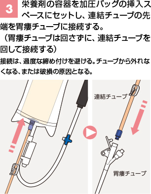 PG加圧バッグⅢ | PG加圧バッグⅢ | ニュートリー株式会社
