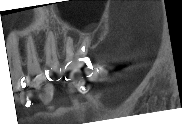 歯科用コーンビームCT 3次元画像診断 – 医療法人 杏済会 坂詰歯科
