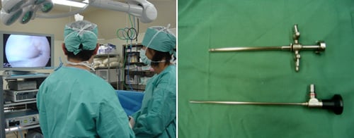 関節鏡視下手術｜医療法人ここの実会 嶋崎病院