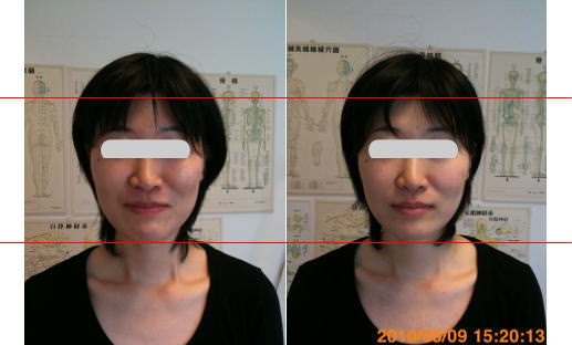 小顔矯正で左右差解消｜大阪・奈良・神戸・心月整体院（女性専用サロン）