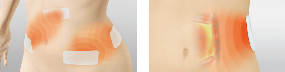 スタイリフト | 電子運動器・美容器 | 伊藤超短波 一般のお客様向けサイト