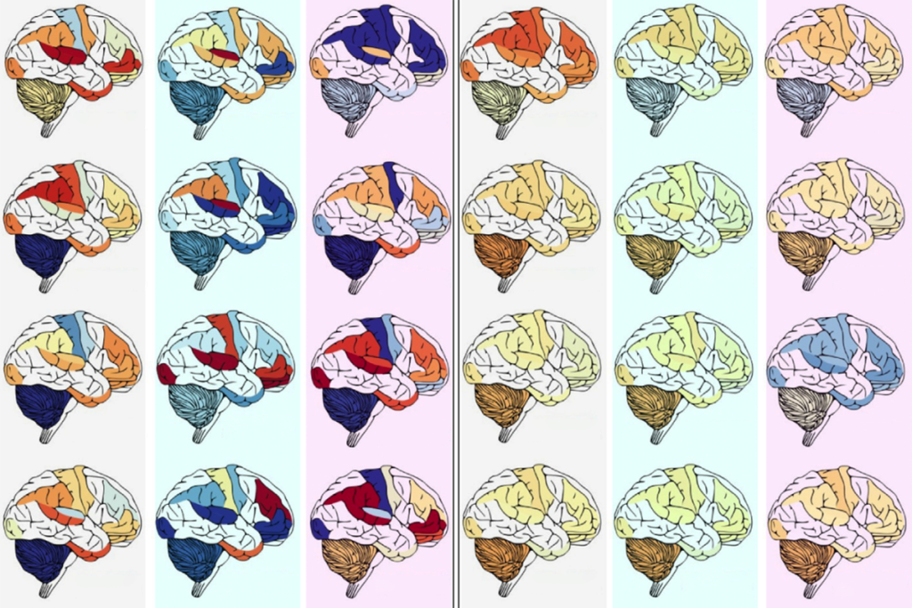 X marks the spot in search for autism variants | The Transmitter