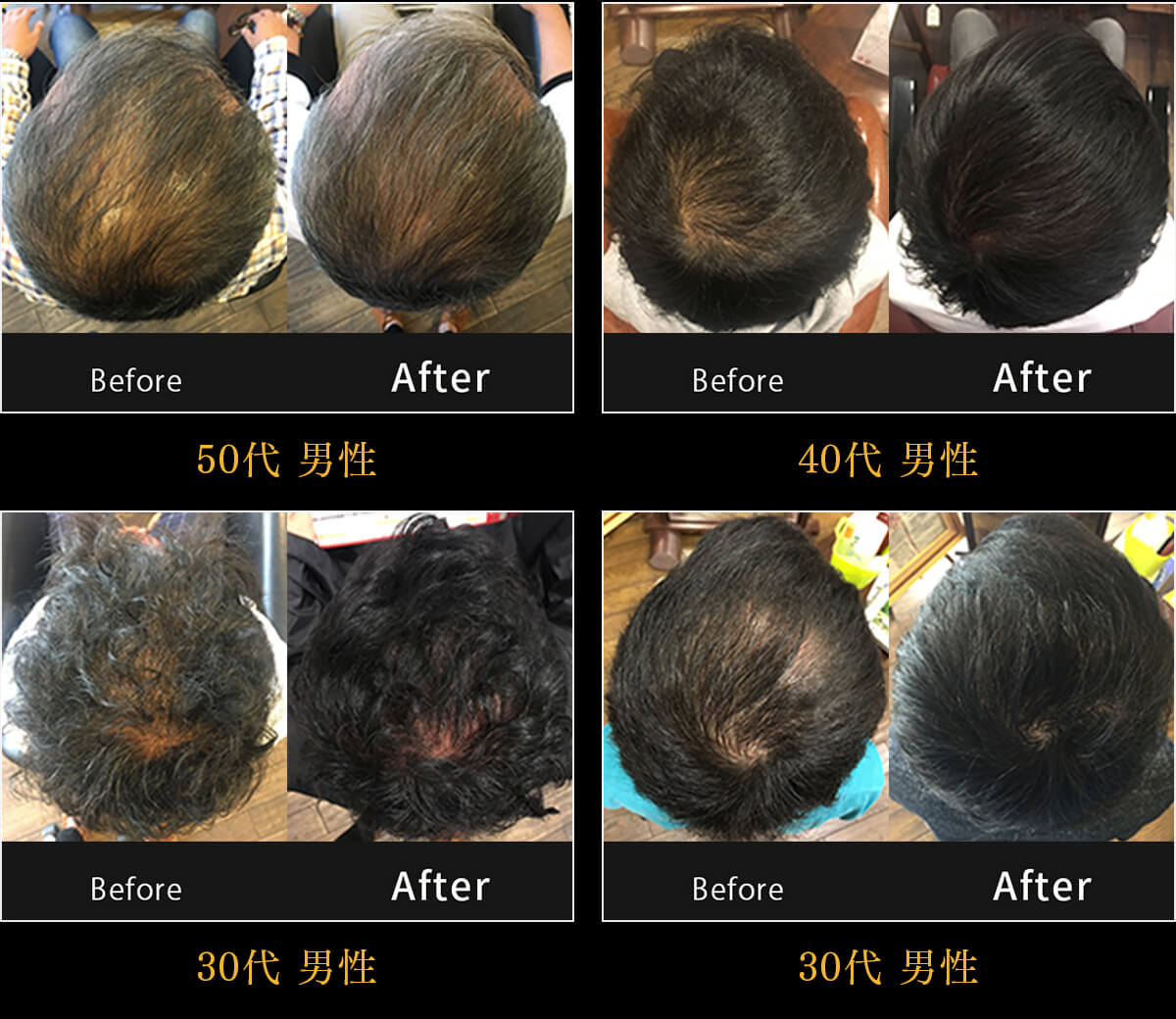 アメリオール 薬用スカルプシャンプー | 内海美容室グループ【アルマダ