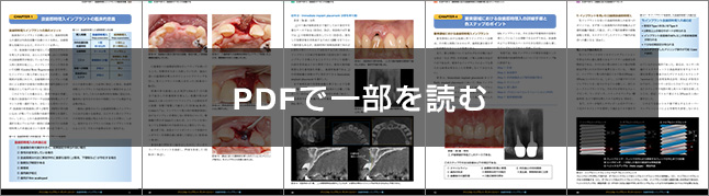 CLINICAL IMPLANT DENTISTRY クリニカル インプラント デンティスト